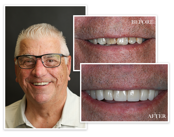 Before and After collage of Patient