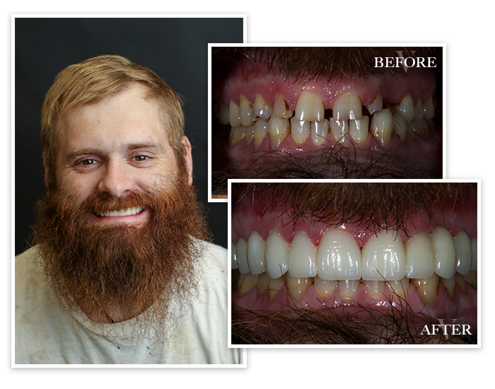 Before and After collage of Patient 3