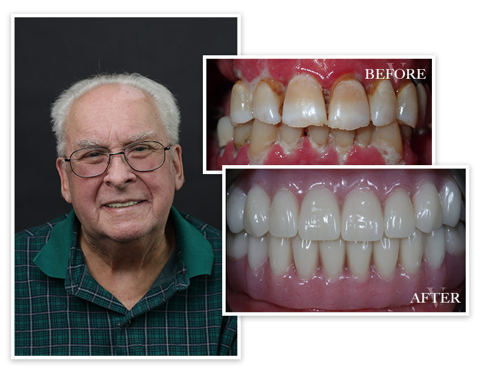 Smile Gallery Patient Collage 4