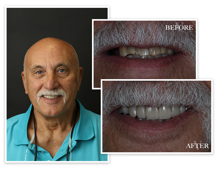 Smile Gallery Collage Patient 6