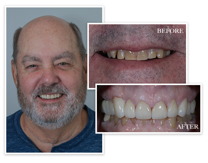 Smile Gallery Collage Patient 7