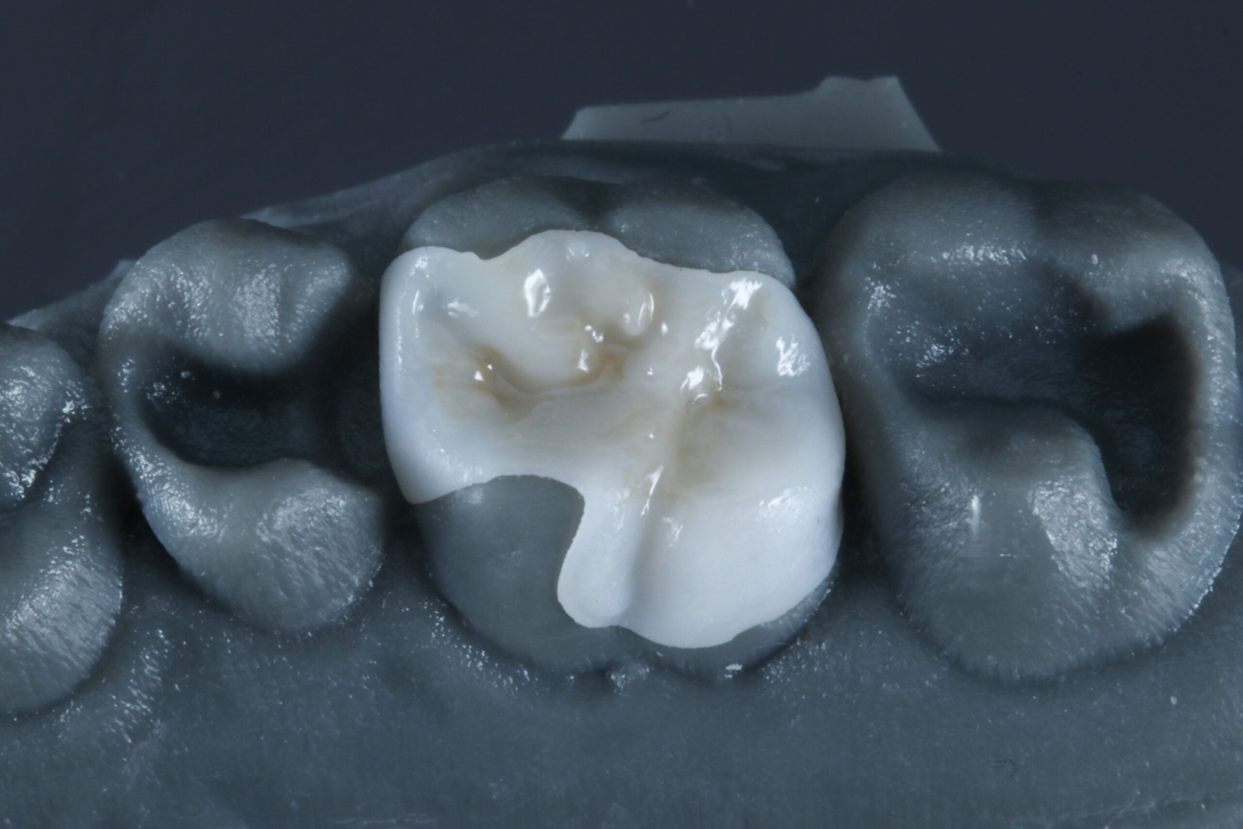 3D-Printed Dentistry