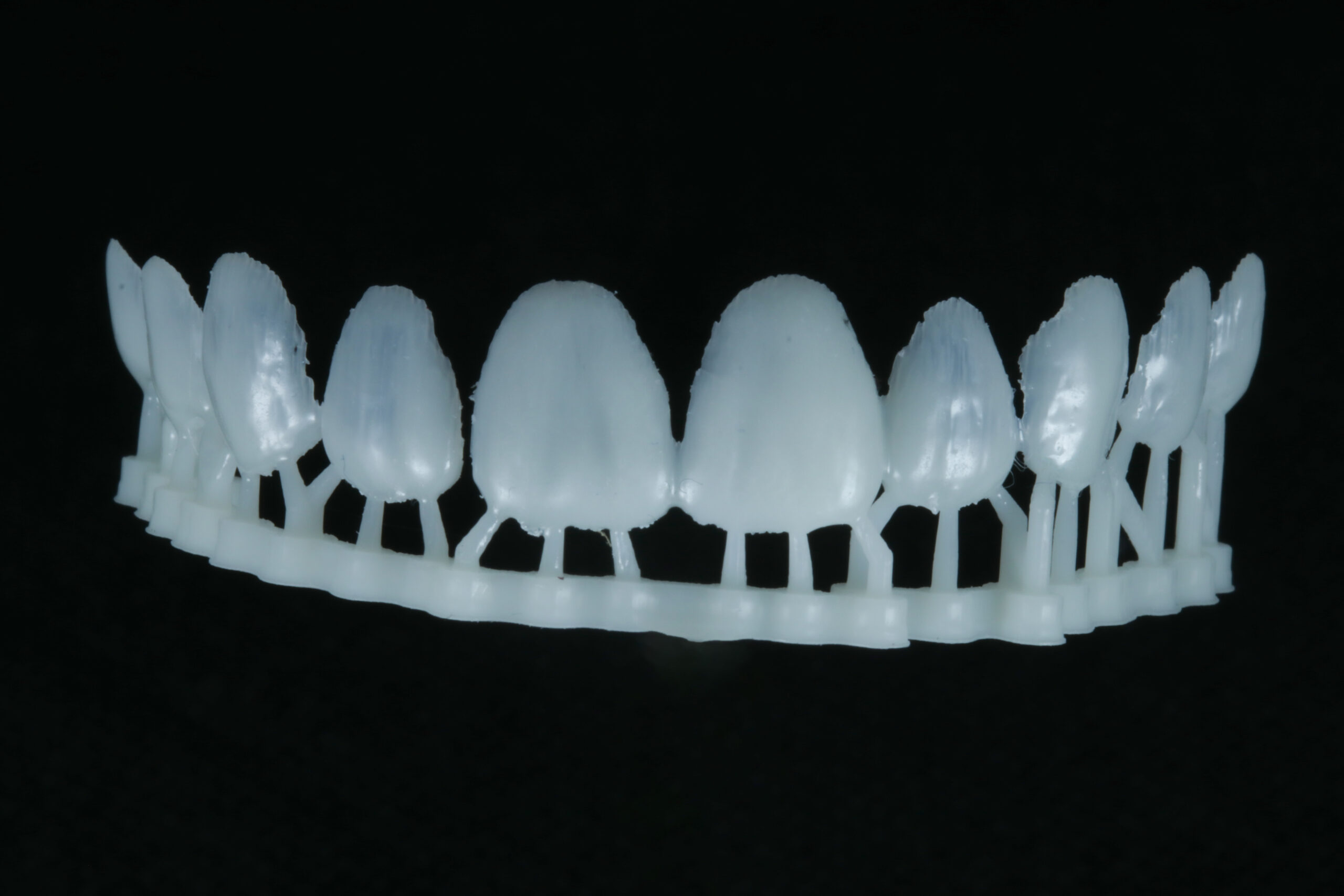 3D-Printed Dentistry